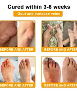 Botulinum Toxin & Bee Venom Orthopedic Relief Cream