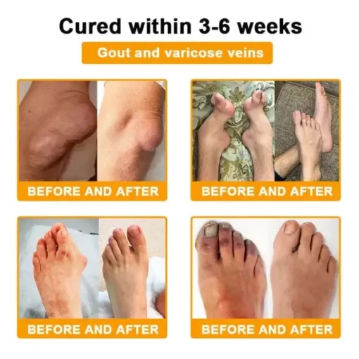 Botulinum Toxin & Bee Venom Orthopedic Relief Cream