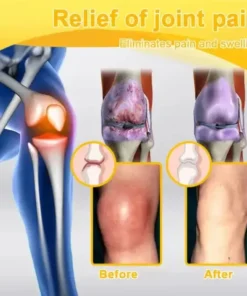 Botulinum Toxin & Bee Venom Orthopedic Relief Cream