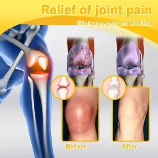 Botulinum Toxin & Bee Venom Orthopedic Relief Cream