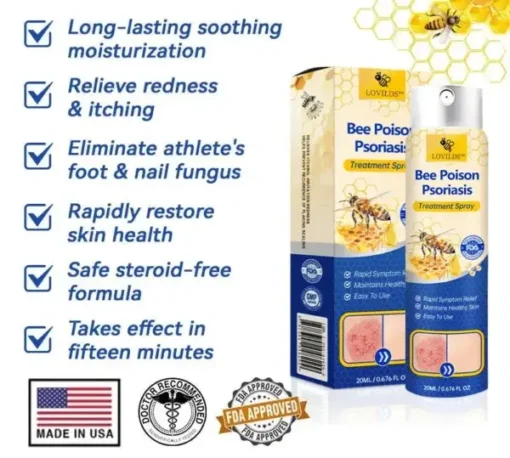 Semprotan Psoriasis LOVILDS™ PsoriaHeal untuk psoriasis
