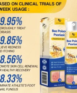 Semprotan Psoriasis LOVILDS™ PsoriaHeal untuk psoriasis