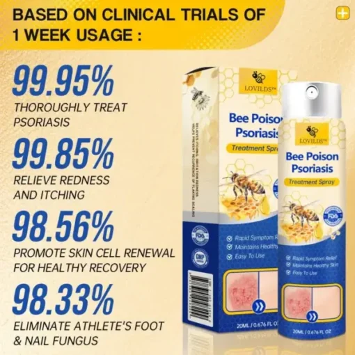 Semprotan Psoriasis LOVILDS™ PsoriaHeal untuk psoriasis