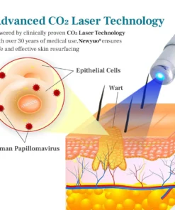 Newyuo® LumeSkin Mole and Wart Removal Laser Pen