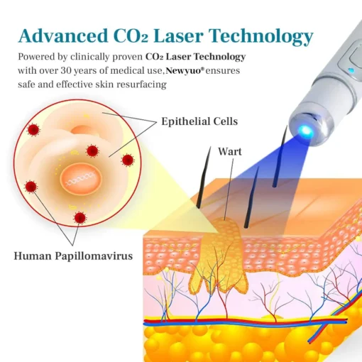 Newyuo® LumeSkin Mole and Wart Removal Laser Pen