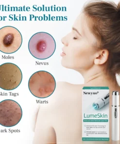 Newyuo® LumeSkin Mole and Wart Removal Laser Pen