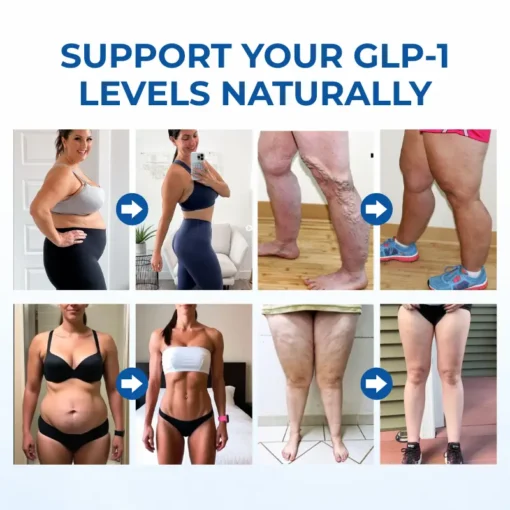 티밀크® 슬림사이다 GLP-1 사과식초 젤리