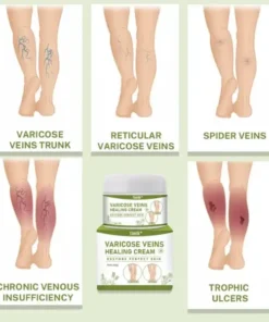 Timilk® Varicose Veins Healing Cream