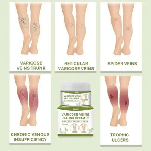 Timilk® Varicose Veins Healing Cream