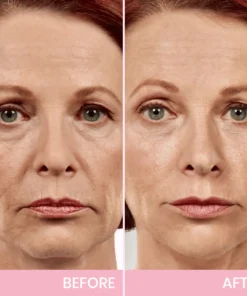 V-Face Lifting Invisible Adhesive Tape 10