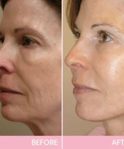 V-Face Lifting Invisible Adhesive Tape 10