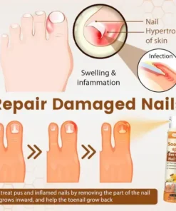 VanaSculpt® Bee Venom Nail Fungus Spray