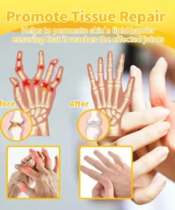 𝐎𝐮𝐫𝐥𝐲𝐚𝐫𝐝® 𝐁𝐨𝐭𝐮𝐥𝐢𝐧𝐮𝐦 𝐓𝐨𝐱𝐢𝐧 & 𝐁𝐞𝐞 𝐕𝐞𝐧𝐨𝐦 𝐏𝐚𝐢𝐧-𝐑𝐞𝐥𝐢𝐞𝐟 𝐁𝐨𝐧𝐞 𝐇𝐞𝐚𝐥𝐢𝐧𝐠 𝐂𝐫𝐞𝐚𝐦