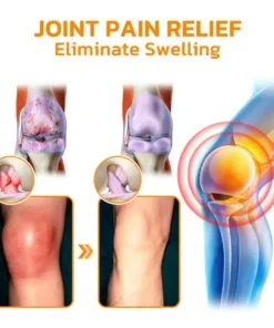 𝐎𝐮𝐫𝐥𝐲𝐚𝐫𝐝® 𝐁𝐨𝐭𝐮𝐥𝐢𝐧𝐮𝐦 𝐓𝐨𝐱𝐢𝐧 & 𝐁𝐞𝐞 𝐕𝐞𝐧𝐨𝐦 𝐏𝐚𝐢𝐧-𝐑𝐞𝐥𝐢𝐞𝐟 𝐁𝐨𝐧𝐞 𝐇𝐞𝐚𝐥𝐢𝐧𝐠 𝐂𝐫𝐞𝐚𝐦