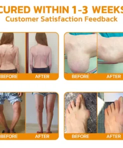 𝐎𝐮𝐫𝐥𝐲𝐚𝐫𝐝® 𝐁𝐨𝐭𝐮𝐥𝐢𝐧𝐮𝐦 𝐓𝐨𝐱𝐢𝐧 & 𝐁𝐞𝐞 𝐕𝐞𝐧𝐨𝐦 𝐏𝐚𝐢𝐧-𝐑𝐞𝐥𝐢𝐞𝐟 𝐁𝐨𝐧𝐞 𝐇𝐞𝐚𝐥𝐢𝐧𝐠 𝐂𝐫𝐞𝐚𝐦