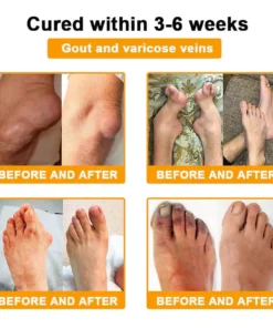 𝐎𝐮𝐫𝐥𝐲𝐚𝐫𝐝® 𝐁𝐨𝐭𝐮𝐥𝐢𝐧𝐮𝐦 𝐓𝐨𝐱𝐢𝐧 & 𝐁𝐞𝐞 𝐕𝐞𝐧𝐨𝐦 𝐏𝐚𝐢𝐧-𝐑𝐞𝐥𝐢𝐞𝐟 𝐁𝐨𝐧𝐞 𝐇𝐞𝐚𝐥𝐢𝐧𝐠 𝐂𝐫𝐞𝐚𝐦