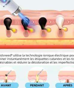 𝐤𝐢𝐝𝐬𝐧𝐞𝐞𝐝® 𝐆𝐫𝐚𝐢𝐧𝐬 𝐝𝐞 𝐛𝐞𝐚𝐮𝐭é 𝐞𝐭 𝐯𝐞𝐫𝐫𝐮𝐞𝐬 𝐧𝐨𝐧 𝐢𝐧𝐯𝐚𝐬𝐢𝐟𝐬 𝐒𝐭𝐲𝐥𝐨 𝐥𝐚𝐬𝐞𝐫 𝐝'é𝐥𝐢𝐦𝐢𝐧𝐚𝐭𝐢𝐨𝐧