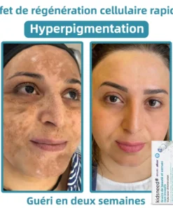 𝐤𝐢𝐝𝐬𝐧𝐞𝐞𝐝® 𝐆𝐫𝐚𝐢𝐧𝐬 𝐝𝐞 𝐛𝐞𝐚𝐮𝐭é 𝐞𝐭 𝐯𝐞𝐫𝐫𝐮𝐞𝐬 𝐧𝐨𝐧 𝐢𝐧𝐯𝐚𝐬𝐢𝐟𝐬 𝐒𝐭𝐲𝐥𝐨 𝐥𝐚𝐬𝐞𝐫 𝐝'é𝐥𝐢𝐦𝐢𝐧𝐚𝐭𝐢𝐨𝐧