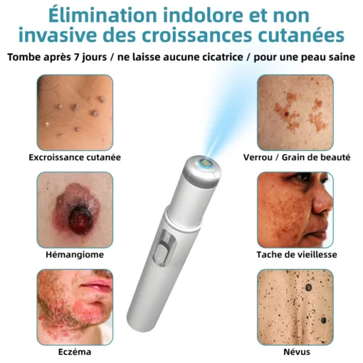 𝐤𝐢𝐝𝐬𝐧𝐞𝐞𝐝® 𝐆𝐫𝐚𝐢𝐧𝐬 𝐝𝐞 𝐛𝐞𝐚𝐮𝐭é 𝐞𝐭 𝐯𝐞𝐫𝐫𝐮𝐞𝐬 𝐧𝐨𝐧 𝐢𝐧𝐯𝐚𝐬𝐢𝐟𝐬 𝐒𝐭𝐲𝐥𝐨 𝐥𝐚𝐬𝐞𝐫 𝐝'é𝐥𝐢𝐦𝐢𝐧𝐚𝐭𝐢𝐨𝐧