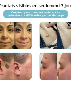 𝐤𝐢𝐝𝐬𝐧𝐞𝐞𝐝® 𝐆𝐫𝐚𝐢𝐧𝐬 𝐝𝐞 𝐛𝐞𝐚𝐮𝐭é 𝐞𝐭 𝐯𝐞𝐫𝐫𝐮𝐞𝐬 𝐧𝐨𝐧 𝐢𝐧𝐯𝐚𝐬𝐢𝐟𝐬 𝐒𝐭𝐲𝐥𝐨 𝐥𝐚𝐬𝐞𝐫 𝐝'é𝐥𝐢𝐦𝐢𝐧𝐚𝐭𝐢𝐨𝐧