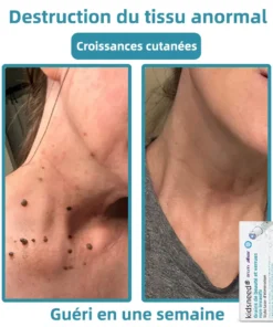 𝐤𝐢𝐝𝐬𝐧𝐞𝐞𝐝® 𝐆𝐫𝐚𝐢𝐧𝐬 𝐝𝐞 𝐛𝐞𝐚𝐮𝐭é 𝐞𝐭 𝐯𝐞𝐫𝐫𝐮𝐞𝐬 𝐧𝐨𝐧 𝐢𝐧𝐯𝐚𝐬𝐢𝐟𝐬 𝐒𝐭𝐲𝐥𝐨 𝐥𝐚𝐬𝐞𝐫 𝐝'é𝐥𝐢𝐦𝐢𝐧𝐚𝐭𝐢𝐨𝐧