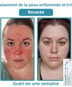 𝐤𝐢𝐝𝐬𝐧𝐞𝐞𝐝® 𝐆𝐫𝐚𝐢𝐧𝐬 𝐝𝐞 𝐛𝐞𝐚𝐮𝐭é 𝐞𝐭 𝐯𝐞𝐫𝐫𝐮𝐞𝐬 𝐧𝐨𝐧 𝐢𝐧𝐯𝐚𝐬𝐢𝐟𝐬 𝐒𝐭𝐲𝐥𝐨 𝐥𝐚𝐬𝐞𝐫 𝐝'é𝐥𝐢𝐦𝐢𝐧𝐚𝐭𝐢𝐨𝐧