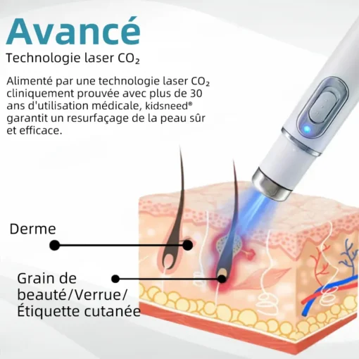 𝐤𝐢𝐝𝐬𝐧𝐞𝐞𝐝® 𝐆𝐫𝐚𝐢𝐧𝐬 𝐝𝐞 𝐛𝐞𝐚𝐮𝐭é 𝐞𝐭 𝐯𝐞𝐫𝐫𝐮𝐞𝐬 𝐧𝐨𝐧 𝐢𝐧𝐯𝐚𝐬𝐢𝐟𝐬 𝐒𝐭𝐲𝐥𝐨 𝐥𝐚𝐬𝐞𝐫 𝐝'é𝐥𝐢𝐦𝐢𝐧𝐚𝐭𝐢𝐨𝐧
