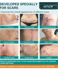 AEXZR™ Advanced Scar Spray