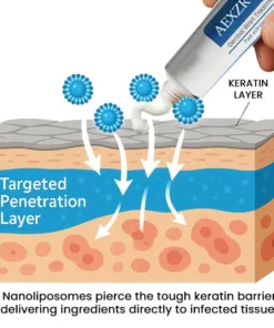 AEXZR® HPV Genital Wart Treatment Cream