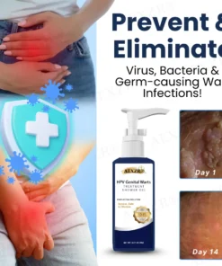 Jela Serşokê ya AEXZR® HPV ya Dermankirina Bêrîşkên Genîtal