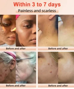 BBOJI™ Orange Enzyme Exfoliating Gel