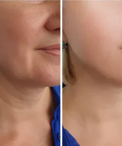 BBOJI™ Orange Enzyme Exfoliating Gel