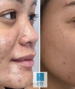 BBOJI™ Orange Enzyme Exfoliating Gel