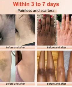 BBOJI™ Orange Enzyme Exfoliating Gel