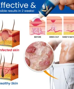 Cvreoz® GentX Relief Crème