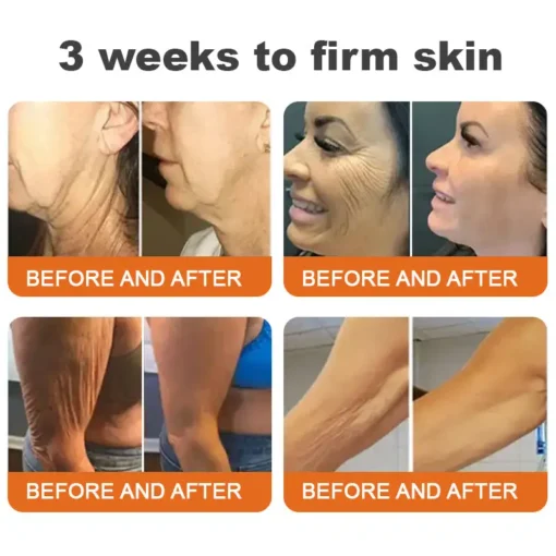 Flysmus® Botox Bee Venom Firming Serum Stick