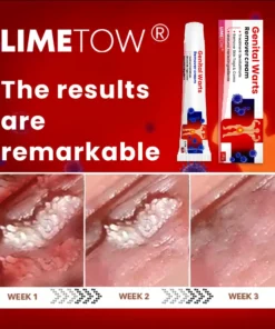 LIMETOW® Genital Warts Remover Cream