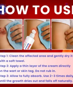 LIMETOW® Genital Warts Remover Cream