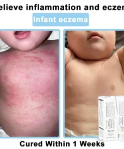 REBYIPO® Official Store: Ruxolitinib Multieffect Repair Cream