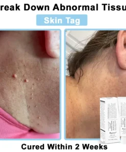 REBYIPO® Official Store: Ruxolitinib Multieffect Repair Cream