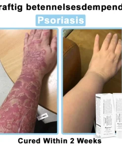 REBYIPO® Official Store: Ruxolitinib Multieffect Repair Cream