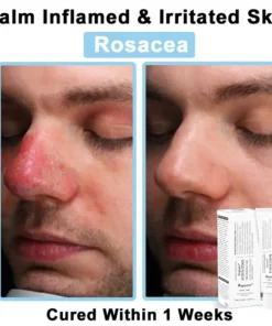 REBYIPO® Official Store: Ruxolitinib Multieffect Repair Cream