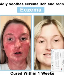 REBYIPO® Official Store: Ruxolitinib Multieffect Repair Cream