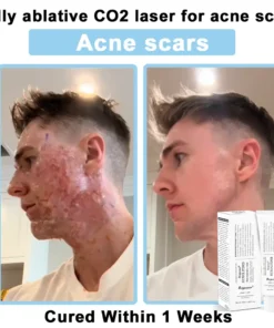 REBYIPO® Official Store: Ruxolitinib Multieffect Repair Cream