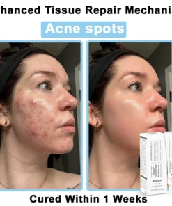 REBYIPO® Official Store: Ruxolitinib Multieffect Repair Cream