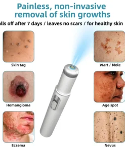Remifa® Non-invasive Mole & Wart Removal Laser Pen