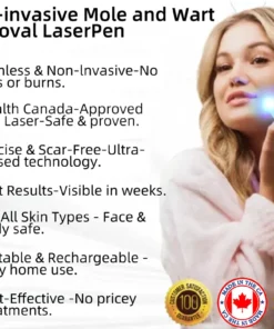 Remifa® Non-invasive Mole & Wart Removal Laser Pen