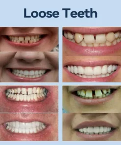 SmileFitPro® – Giảm cân hiệu quả