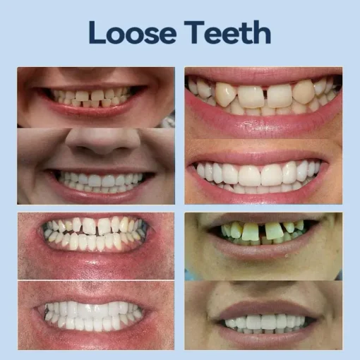 SmileFitPro® – Giảm cân hiệu quả