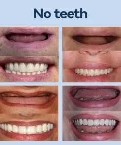 SmileFitPro® – Giảm cân hiệu quả